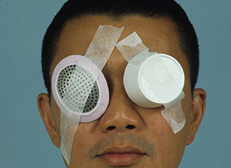 book title Ophthalmic Care of the Combat Casualty